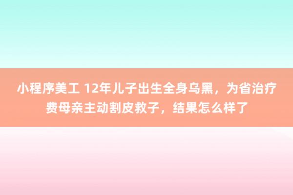 小程序美工 12年儿子出生全身乌黑，为省治疗费母亲主动割皮救子，结果怎么样了